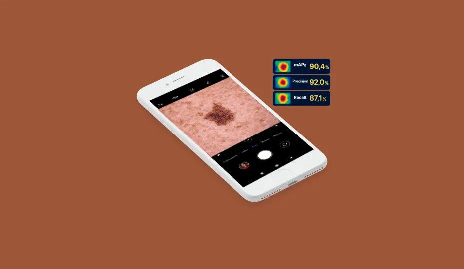 Aplicativo desenvolvido na UFU auxilia na prevenção ao câncer de pele
